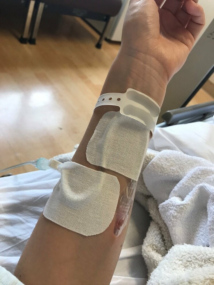 28歳の時に罹患したがんの治療の様子（写真／初野さん提供）