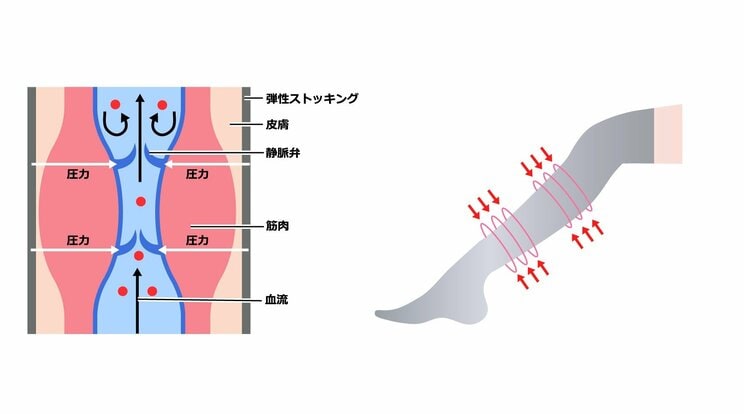 それって下肢静脈瘤かも!? 足がつる、だるい、かゆい…専門医が唱える9つのセルフチェック＆簡単だけど効果絶大の対策_4