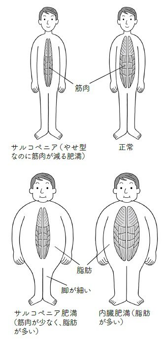 『百歳まで歩ける人の習慣 脚力と血管力を強くする』より