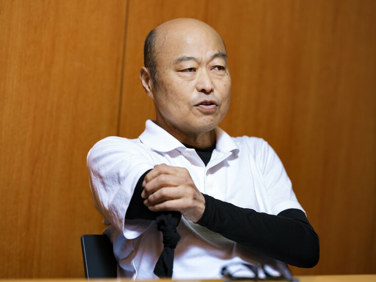 「切り落とした右腕はすぐに焼却処分された。骨だけもらってペンダントにでもしたかったけど、そのときたまたま『グッド・ドクター 名医の条件』というドラマで足を切断するシーンがあって。それがやたらリアルでグロかったからやめました(笑)。まぁ、今さら右腕にこだわっても仕方ないですしね」