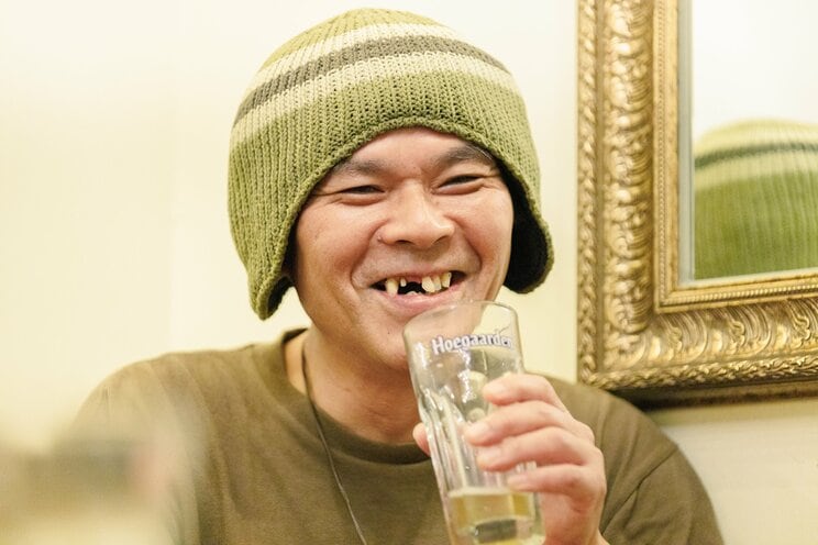 前歯について「20歳のころに酔っぱらって路上ででんぐり返しをしてたらアスファルトに顔をぶつけて欠けた（笑）。当初は被せものをしてたけど神経が死んでたから、15年後くらいに歯ごと抜けちゃった」