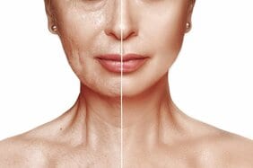むくみや冷え性、シミ、シワ…毛細血管のゴースト化が原因? 老化で減少している毛細血管を元気にする3つの食品
