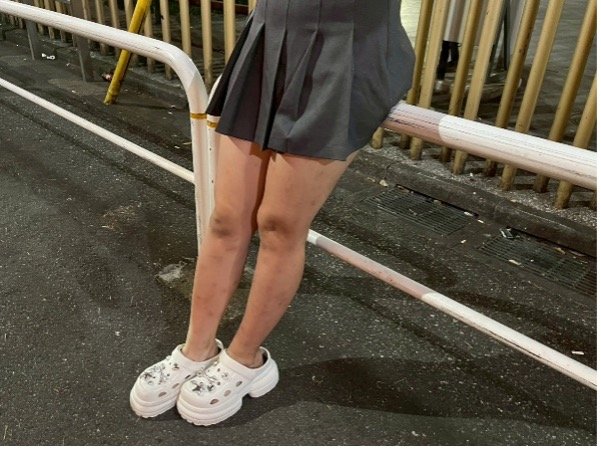 取材に応じるＡ子（撮影/集英社オンライン） 
 