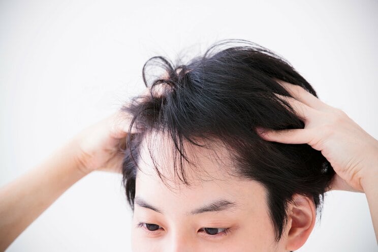 高まる男性の「美髪」意識…頭皮と髪の危険サインは？【美髪プロに聞く】_a