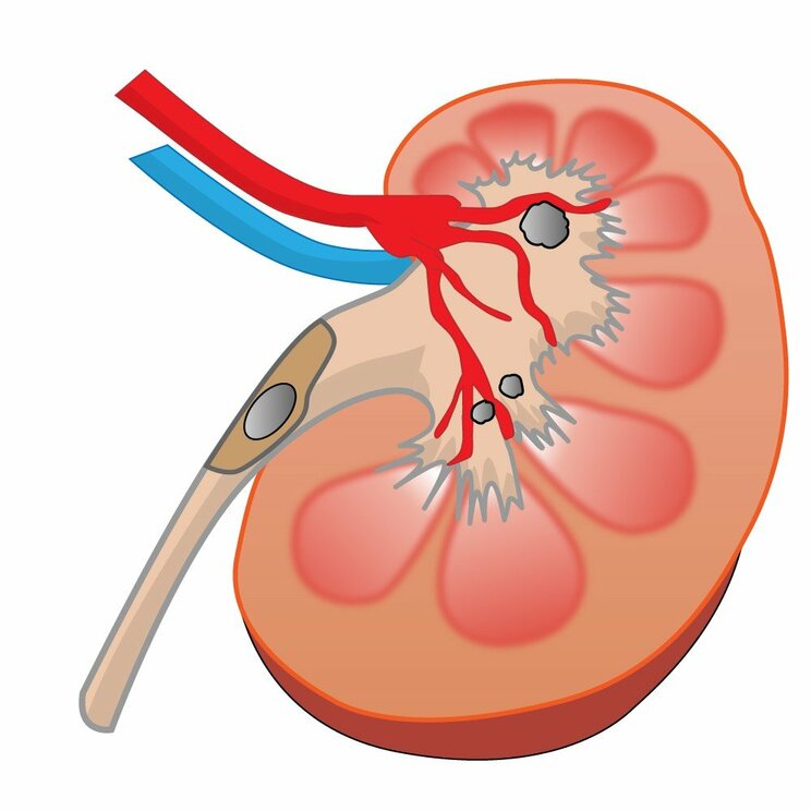 解熱鎮痛剤、胃薬、抗生物質…身近にある薬が実は危険かも？　腎臓に悪い薬５選_2